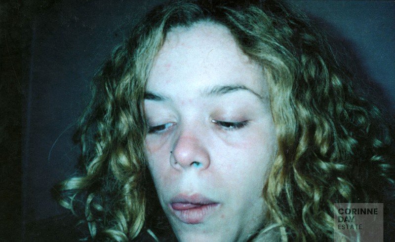 Image 1 of 11